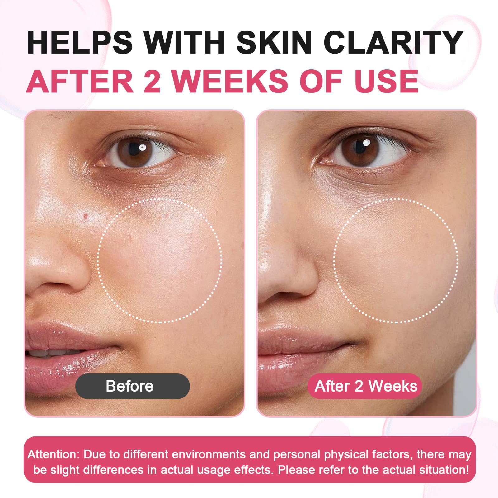 SUDAJI TXA Niacinamide serum is gentle enough for daily morning and night use.