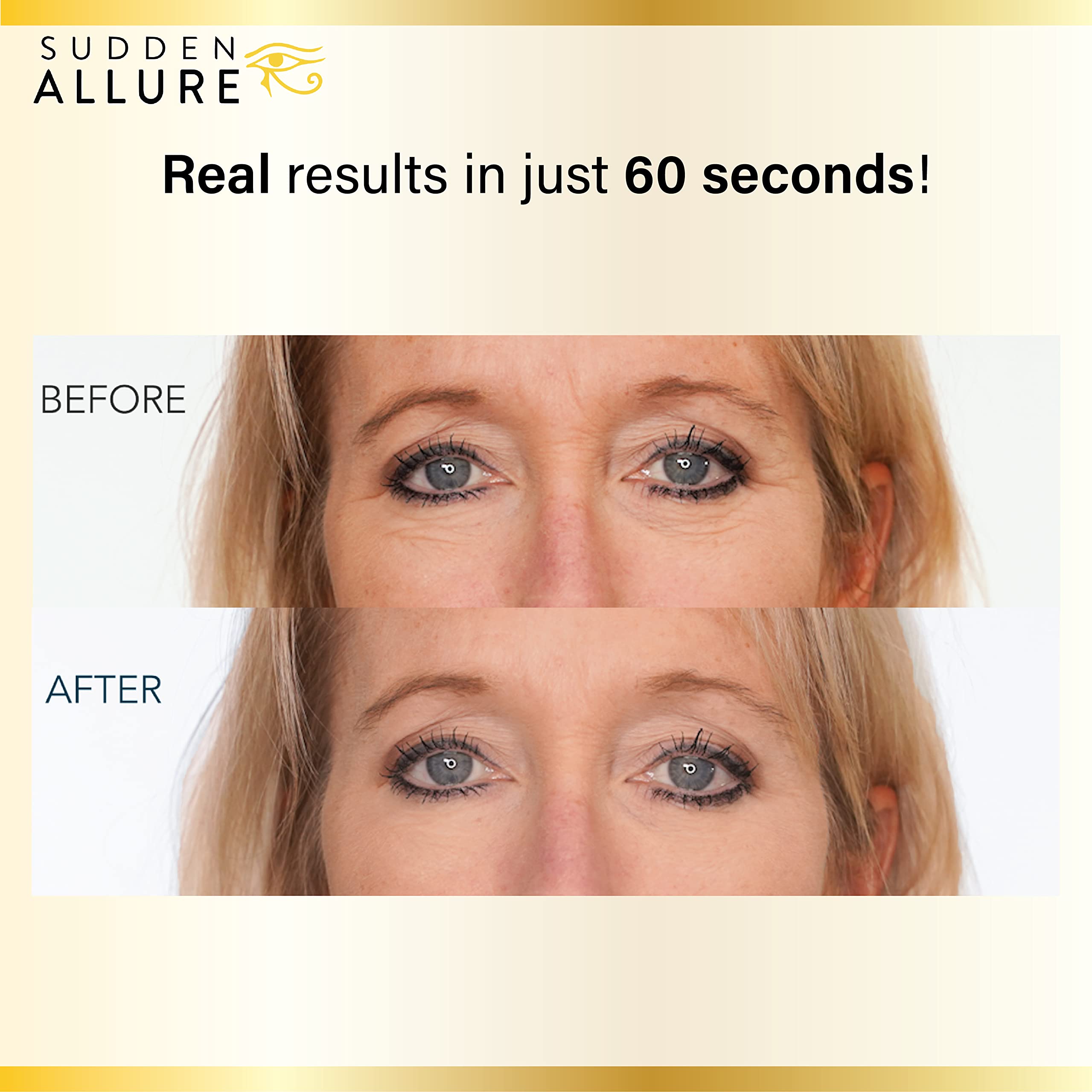 SuddenAllure after 60 seconds shows lifted under-eye area and fewer crow's feet.