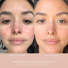 Texture swirls of CC Me Serum on skin