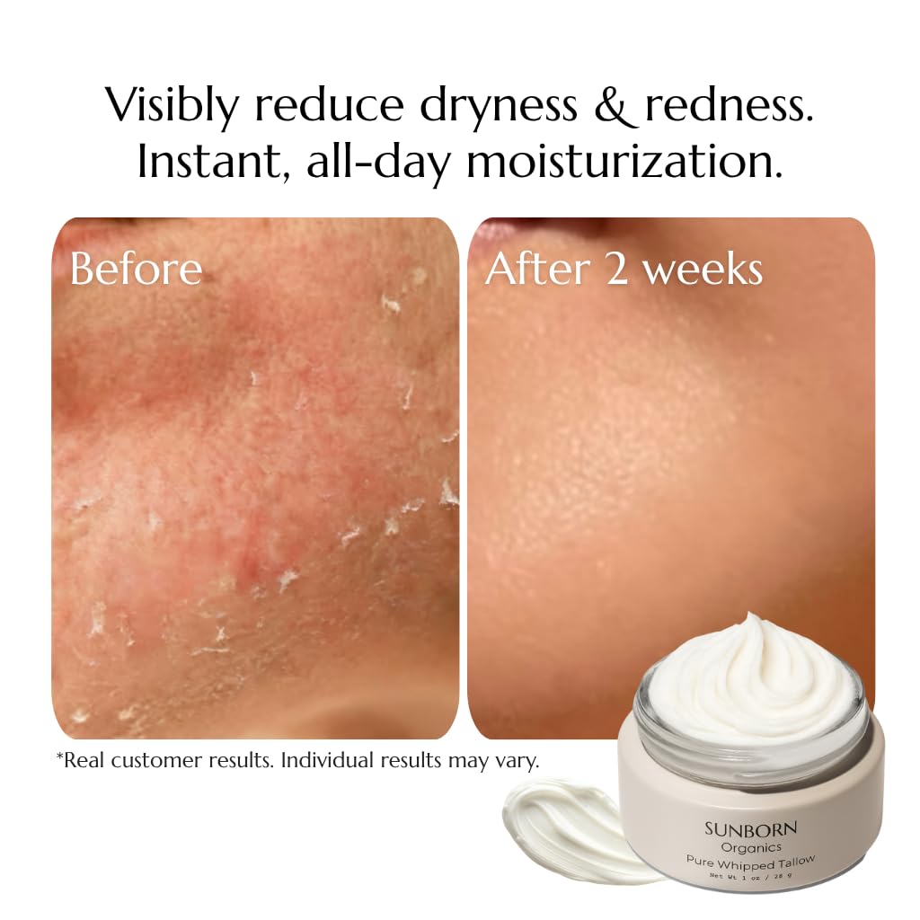 Sunborn Organics Balm application on hand highlights fast-absorbing hydration.