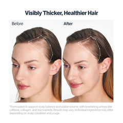 Close-up of dry scalp before treatment with SUNGBOON EDITOR serum