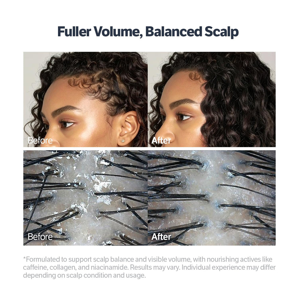 Ingredient montage highlighting tea tree and rosemary for soothing scalp support