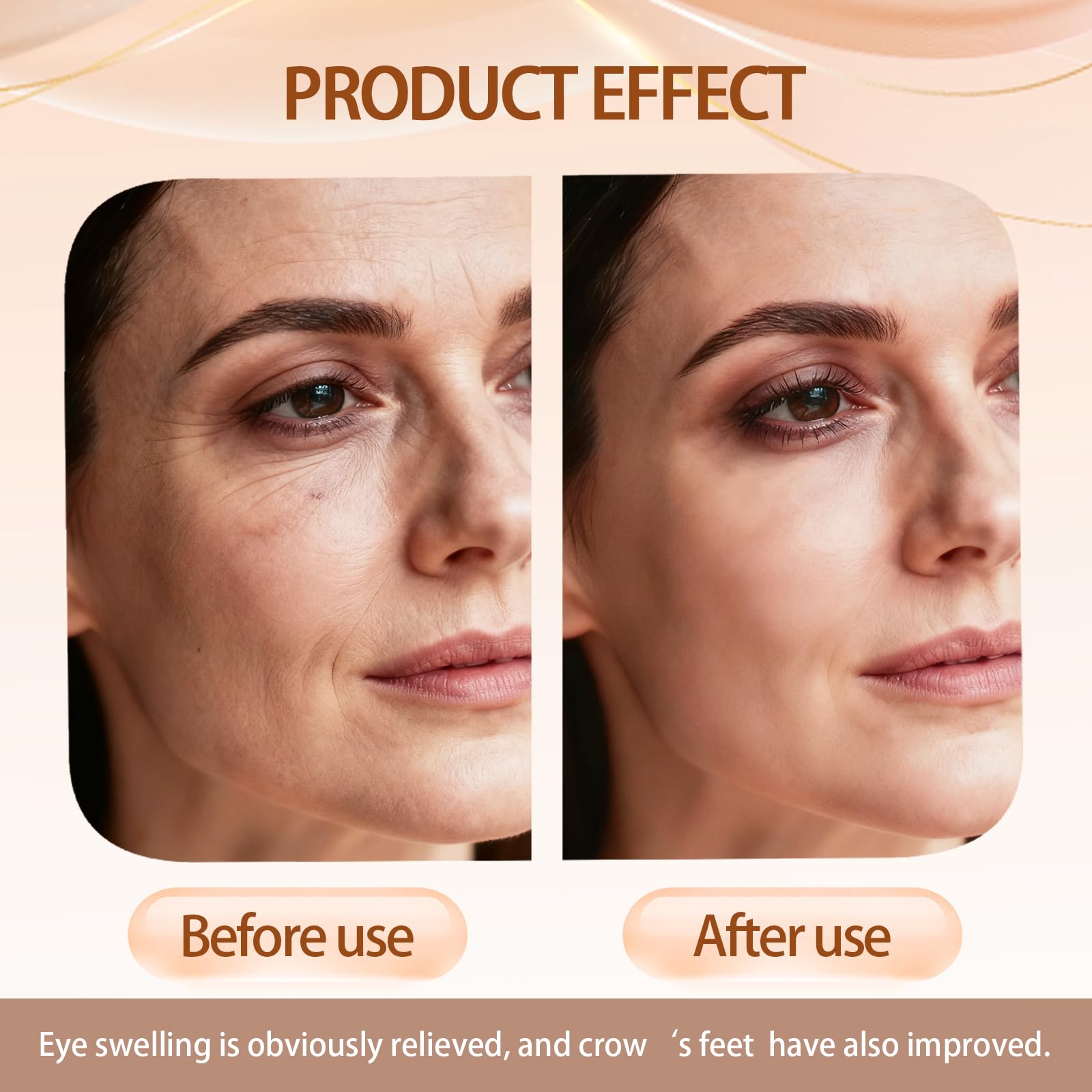 Under-eye puffiness reduced visually after using Sunnydeer Eye Tightener