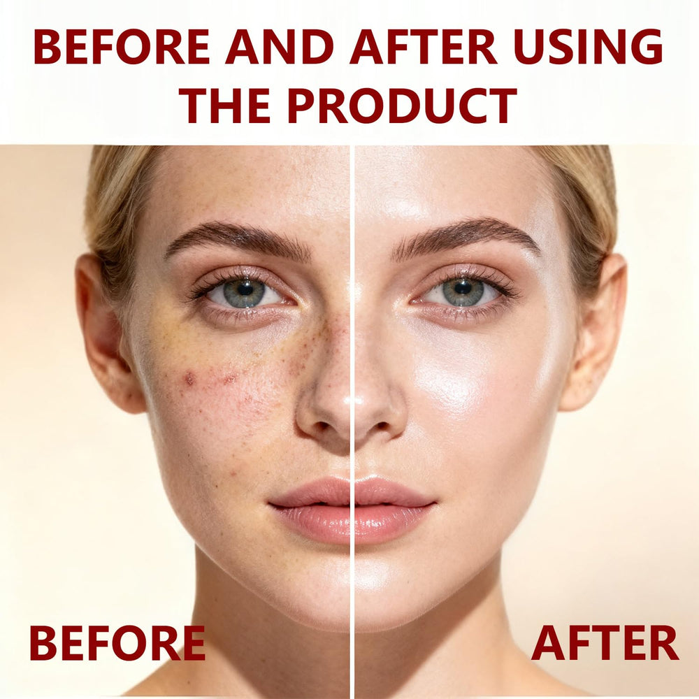 Sunohyesla Hyaluronate-rich nourishment applied to skin for hydration
