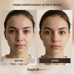 Simple daily routine including SupreH Bee Venom Cream in skincare