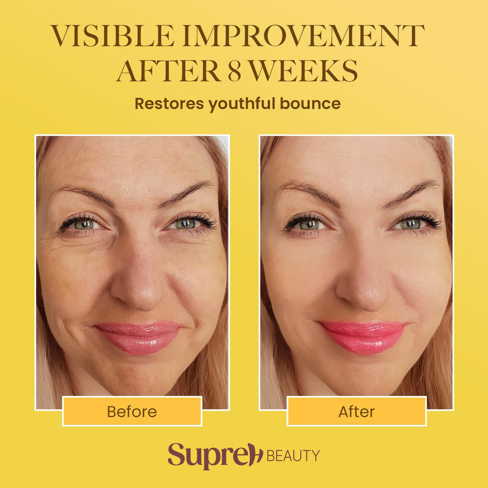 Night application scene with SupreH Bee Venom Cream on the face