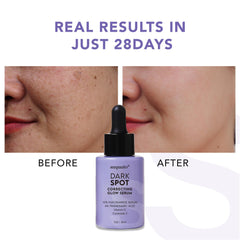 Suquato serum applied on skin providing hydration and glow.