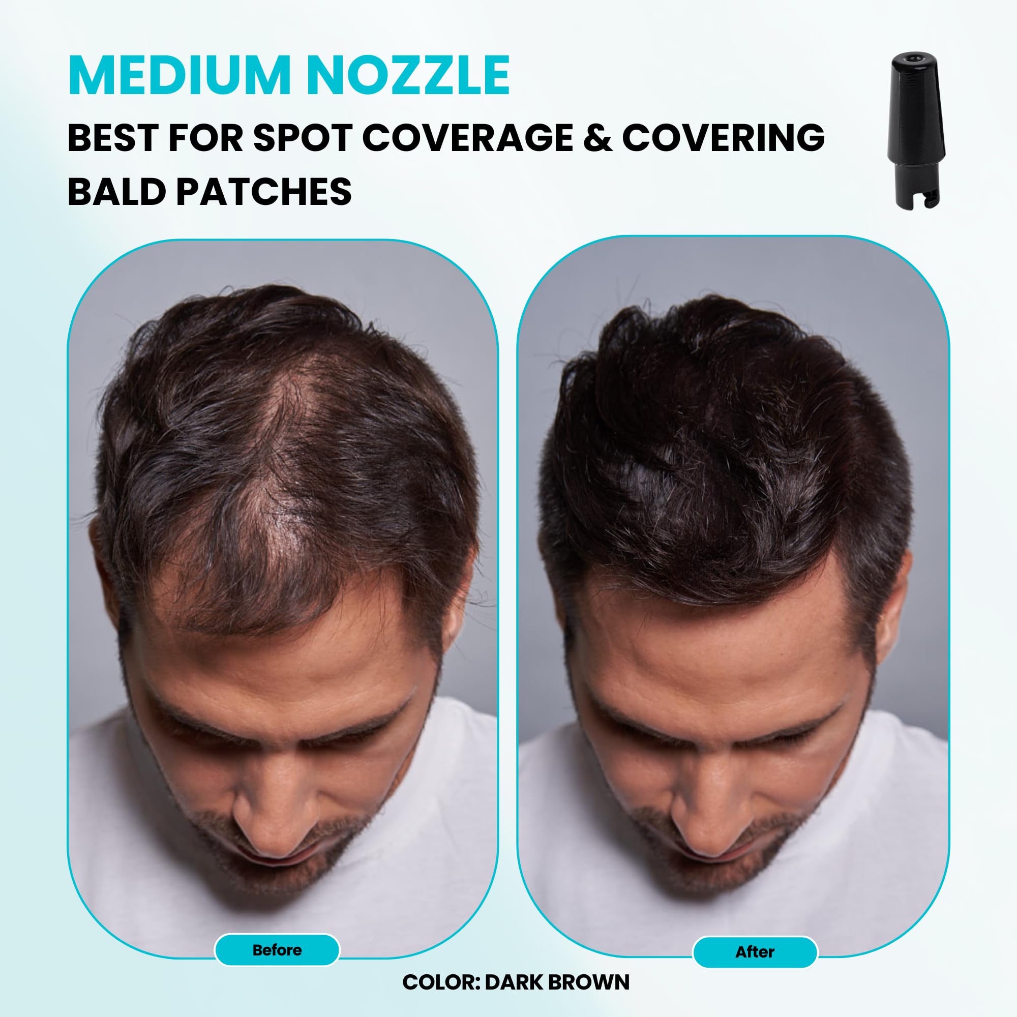 SURETHIK bottle-ready kit supports consistent results with each use.