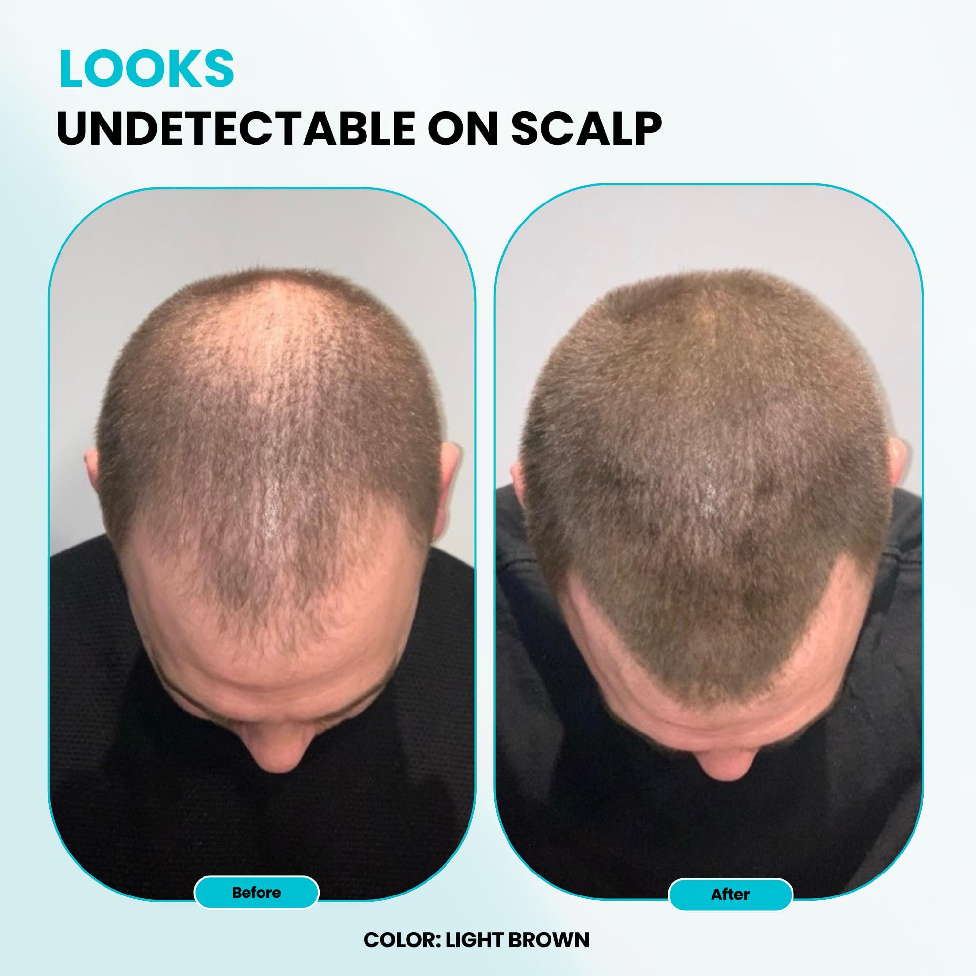 Surethik Light Blonde fibers application routine simplifies daily grooming