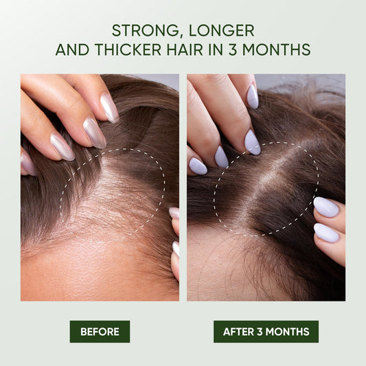 Svvimer Rosemary Shampoo ingredients with biotin and tea tree oil for a refreshed scalp