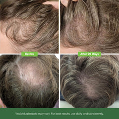 Svvimer rosemary oil ingredient highlighting natural scalp nourishment.