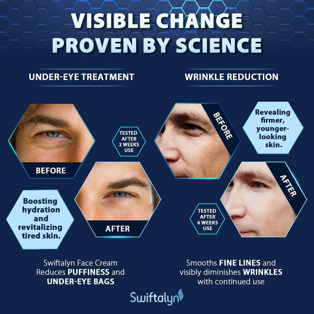 Aftershave use with Swiftalyn cream to reduce redness and comfort skin