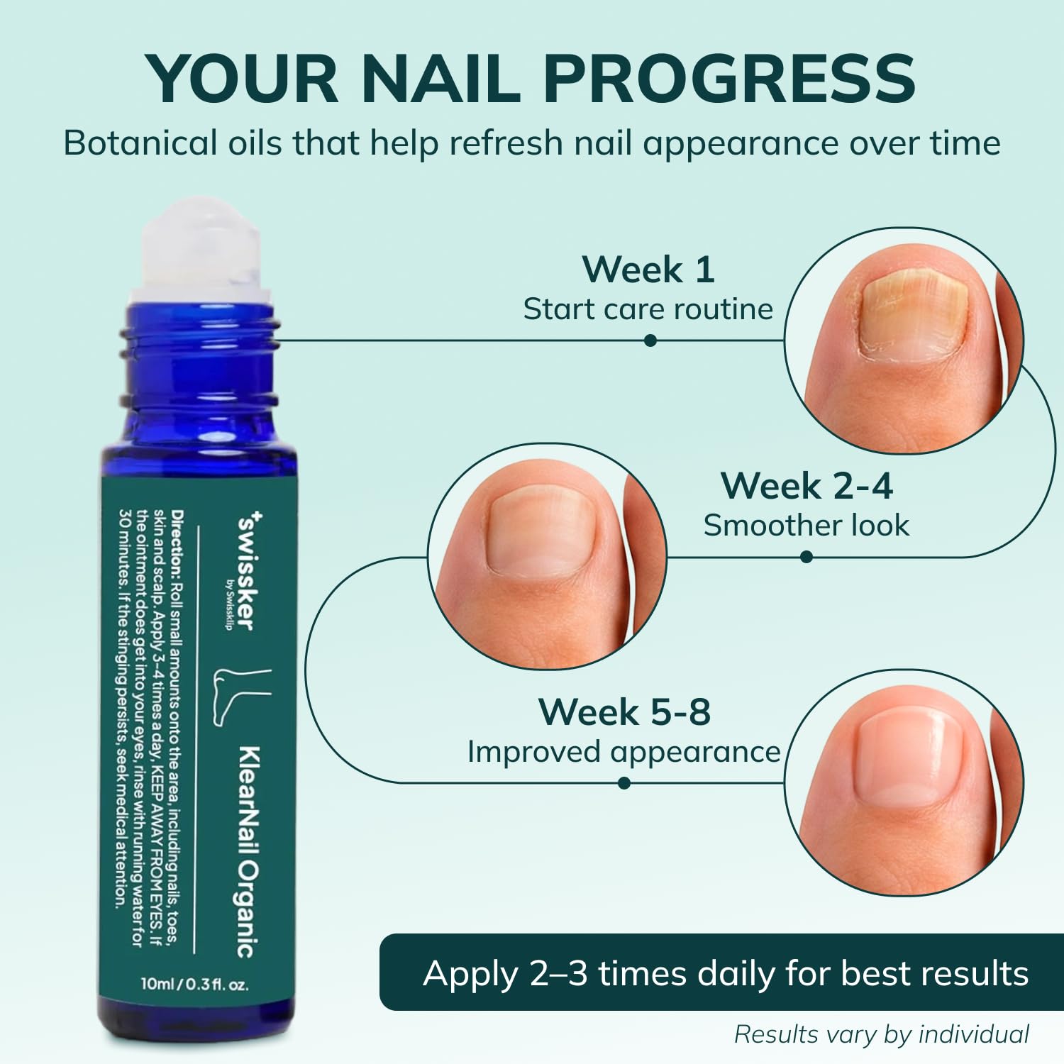 Swissklip KlearNail application on nail illustrates easy usage