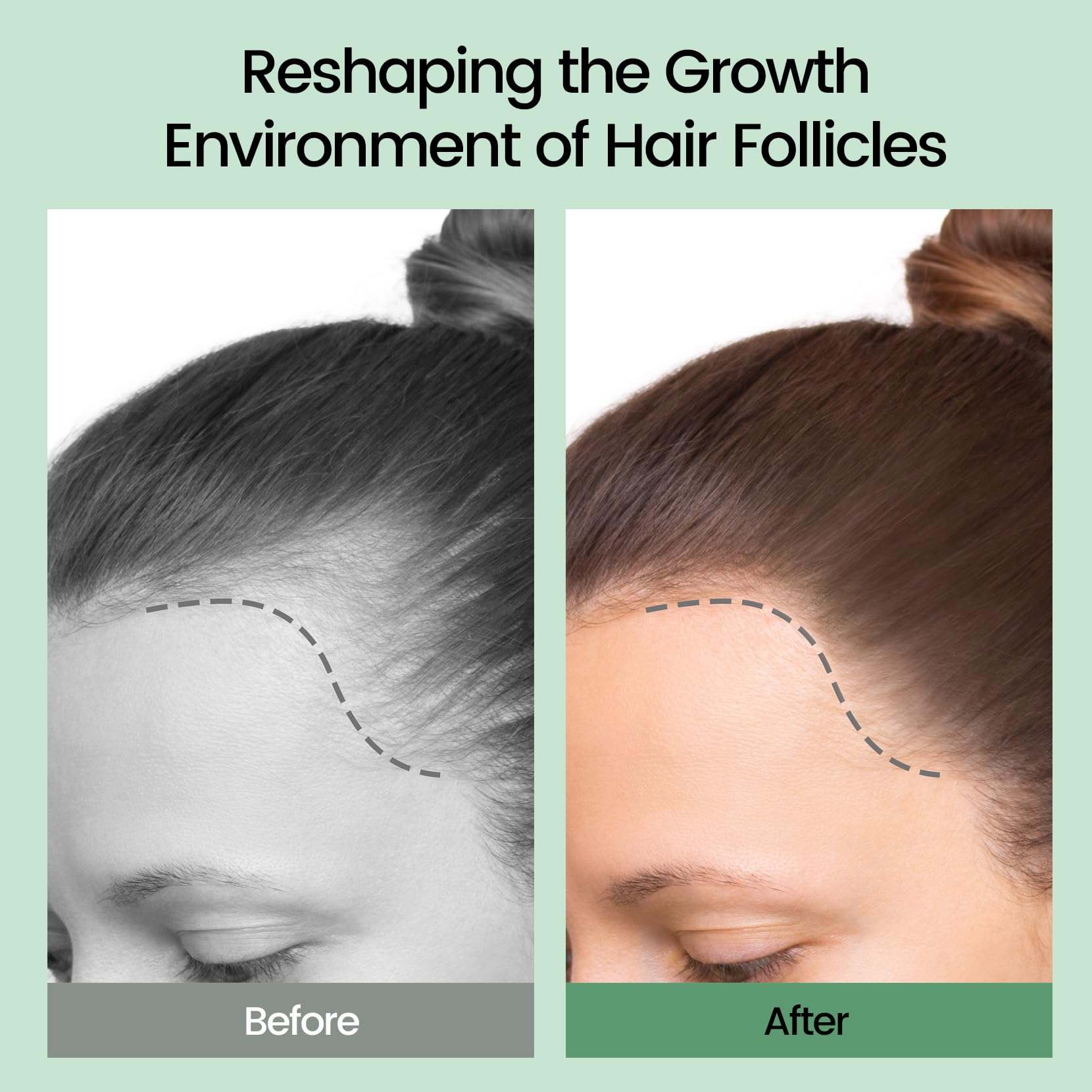 Sysni Rosemary Tea Tree Keratin Shampoo targets hair roots for nourishment.