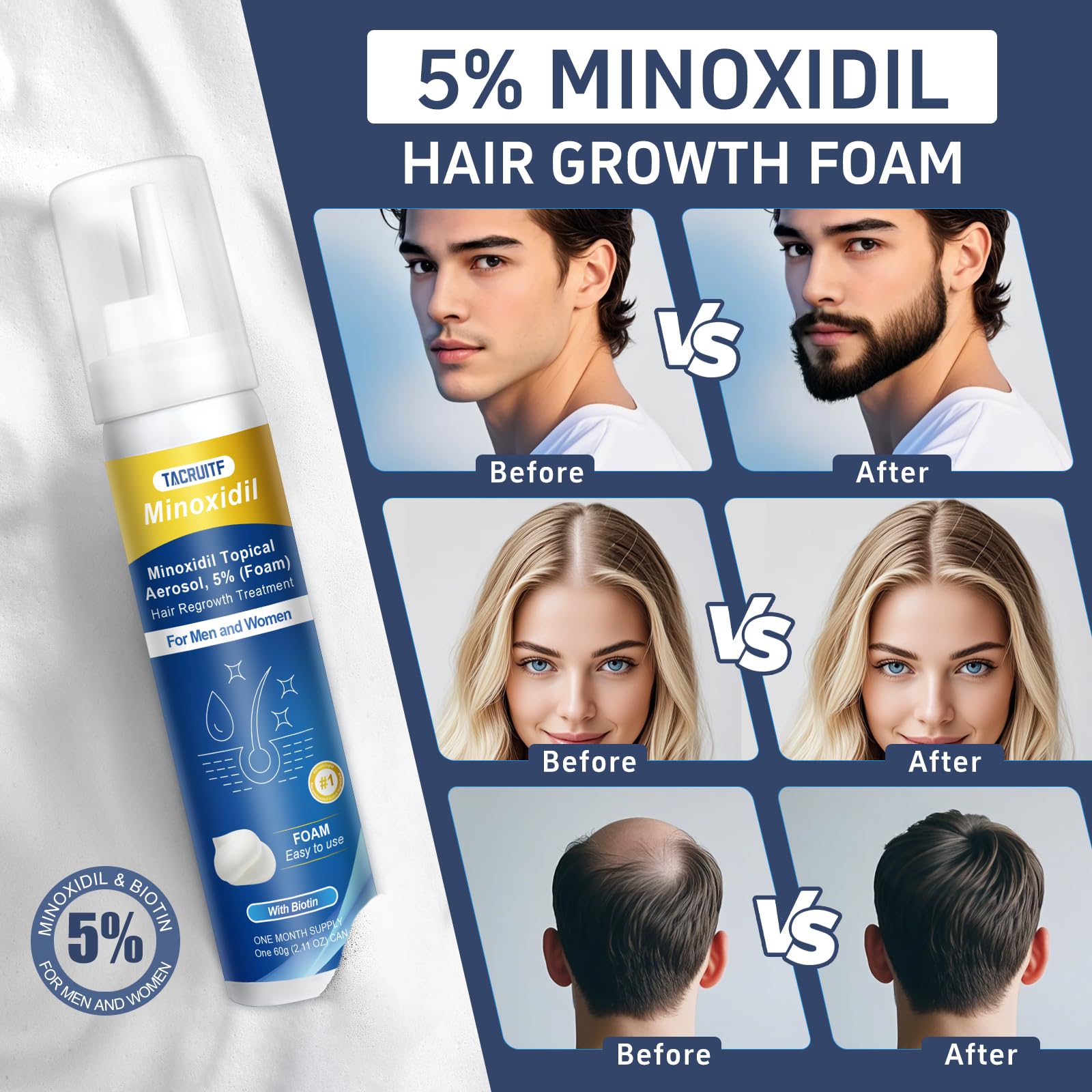 Tacruitf biotin-minoxidil foam closeup highlighting enriched growth ingredients