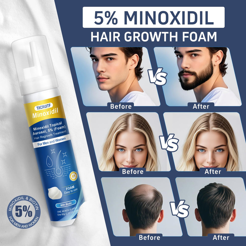 Tacruitf biotin-minoxidil foam closeup highlighting enriched growth ingredients