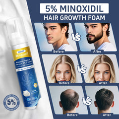 Tacruitf biotin-minoxidil foam closeup highlighting enriched growth ingredients