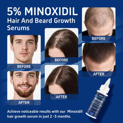 Tacruitf hands applying minoxidil to scalp for home-use hair vitality.