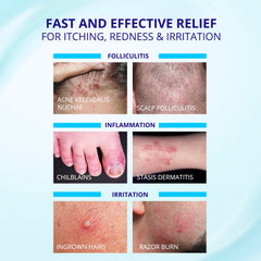 TAGRID Folliculitis Cream texture demonstrates a lightweight, non-greasy finish.