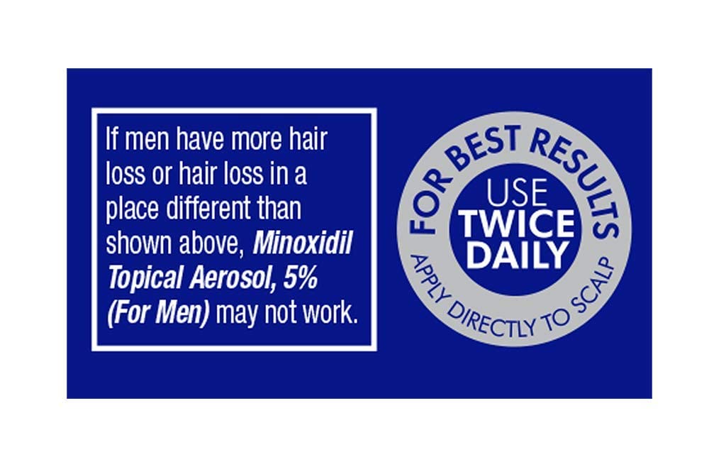 TARO Minoxidil foam on scalp during application