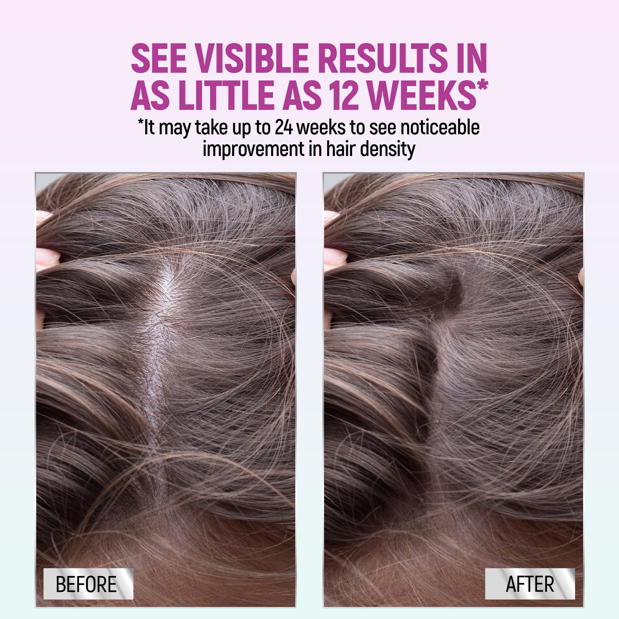 TARO Minoxidil application on scalp showing unscented, gentle formula