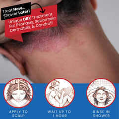 Tarsum coal tar shampoo foam on hand for cleansing