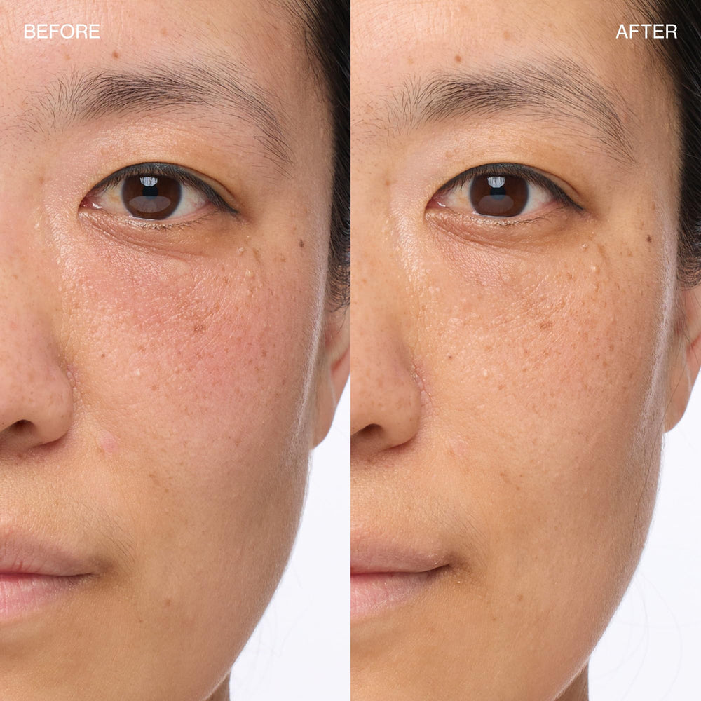 Face application shows how the cream calms redness and supports skin resilience.