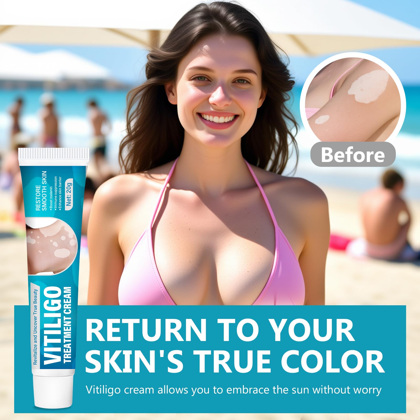 TDZLDM Vitiligo Cream applied to the arm for targeted skin care.