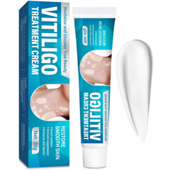 TDZLDM Vitiligo Cream tube shown for easy daily application on affected skin.