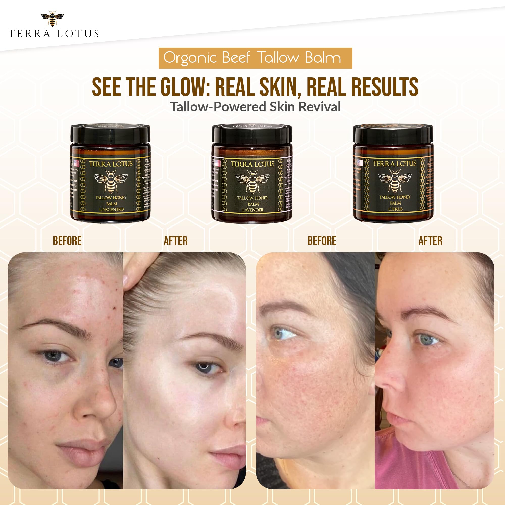 Terra Lotus balm on feet, smoothing dry patches