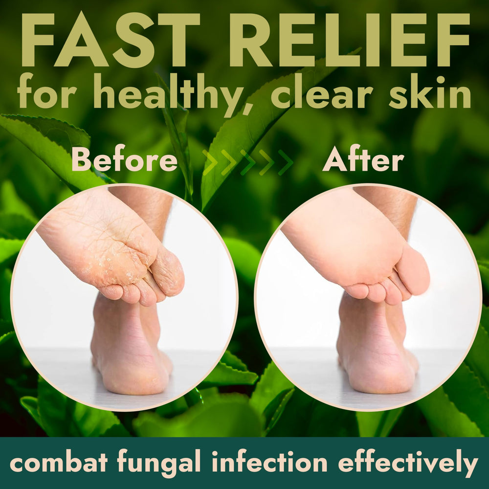 Terramed Just Think Comfort tea tree oil bottle highlighting antibacterial support for feet