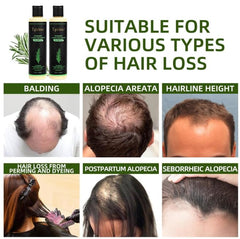 Tgideas rosemary shampoo application on wet hair for cleansing