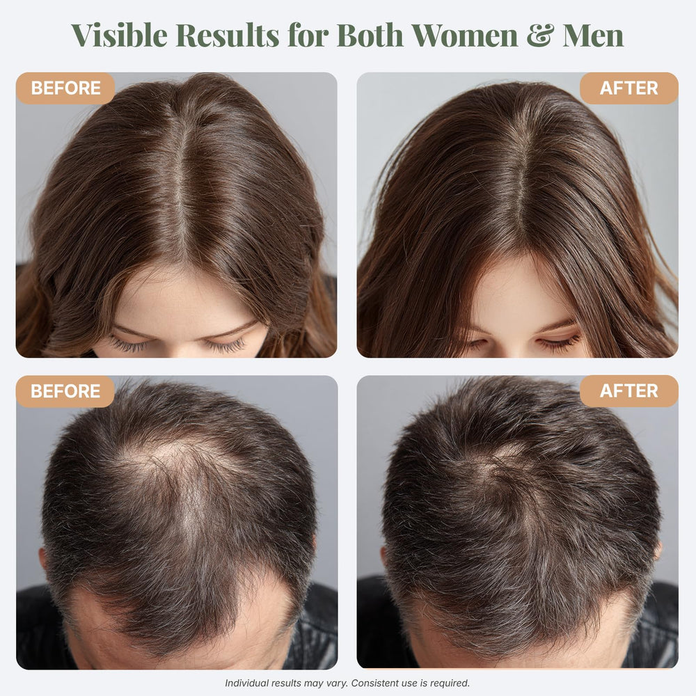 The ELIX rosemary oil notes tea tree scent for refreshing scalp care.