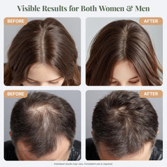 The ELIX rosemary oil notes tea tree scent for refreshing scalp care.
