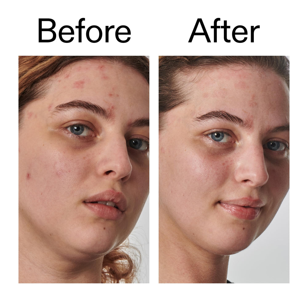 The INKEY List Urea 10% Moisturizer packaging box highlights key benefits.