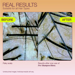 THE ROOTIST scalp treatment being massaged into the scalp to support balance and cleanliness.