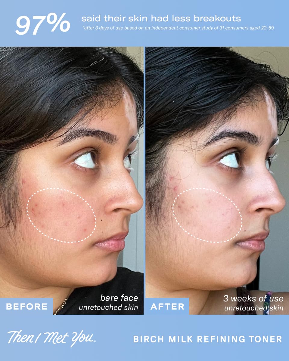 Then I Met You Birch Milk Toner travel size for on-the-go skincare.