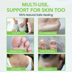 THENA cream on dry, rough heels for smoother feet