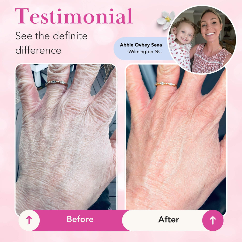 Theraplex Clear Lotion Spray applied to damp skin seals moisture gently.
