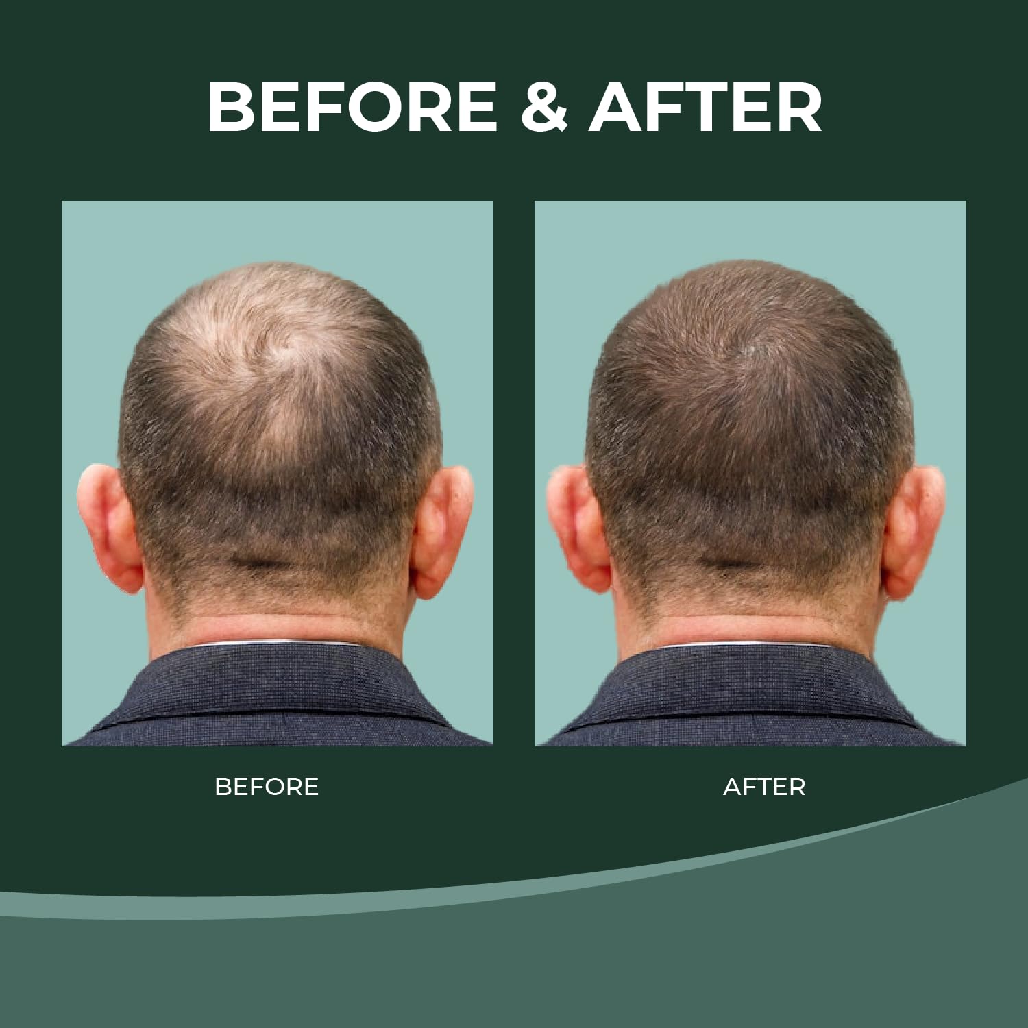Thik&Fix hair thickening effect visual suggesting fuller look