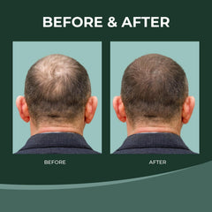 Thik&Fix hair thickening effect visual suggesting fuller look