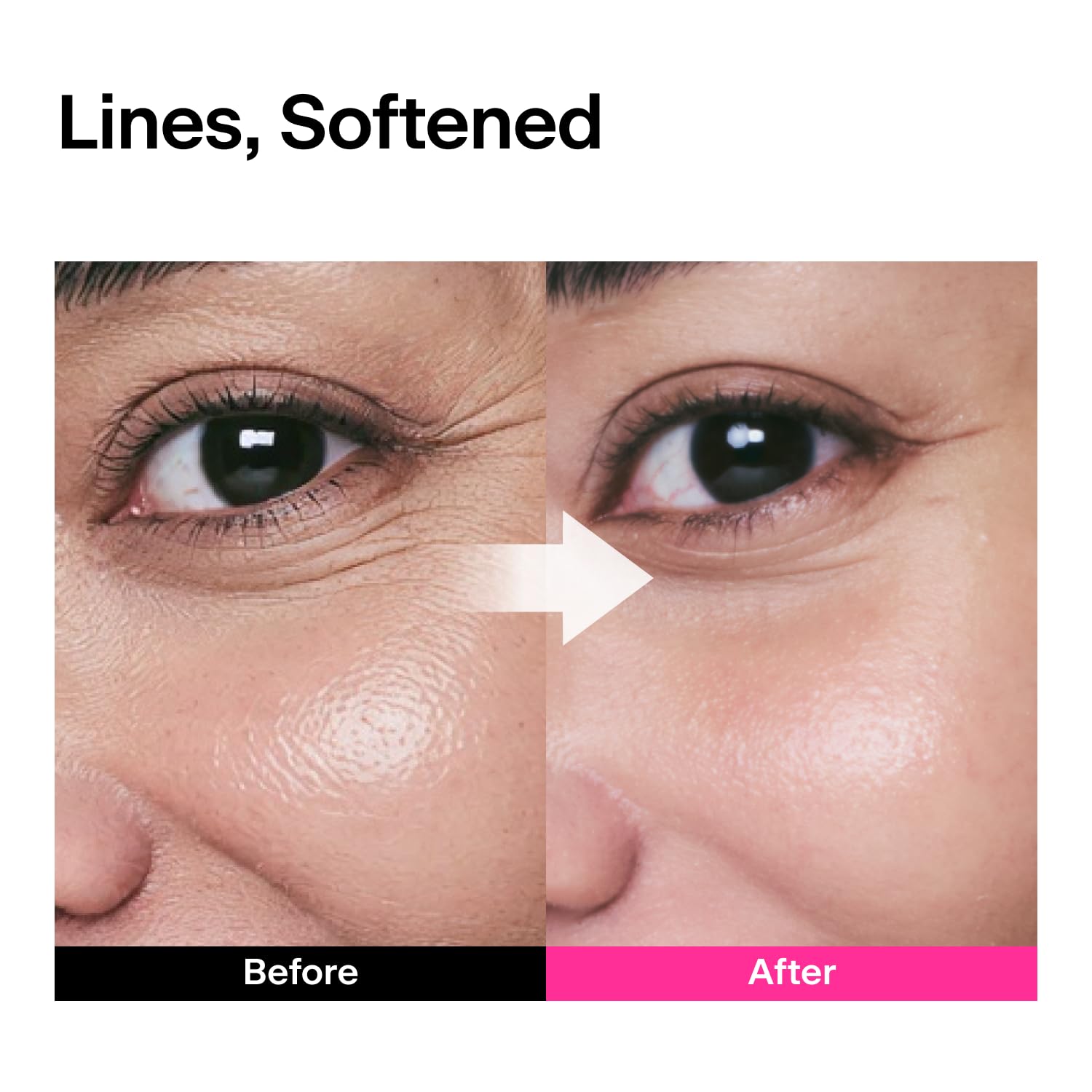 THOME CPR Serum wrinkle zones illustration across the face