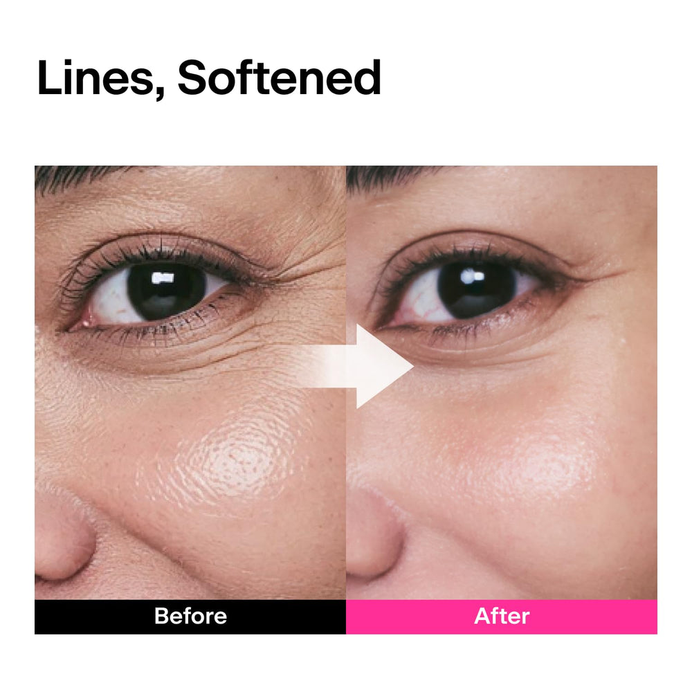 THOME CPR Serum wrinkle zones illustration across the face