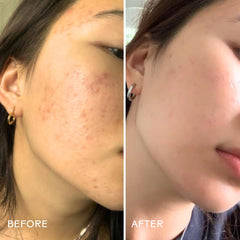 Three Ships Purify Aloe Amino Acid Gel Cleanser applying on skin in circular motions