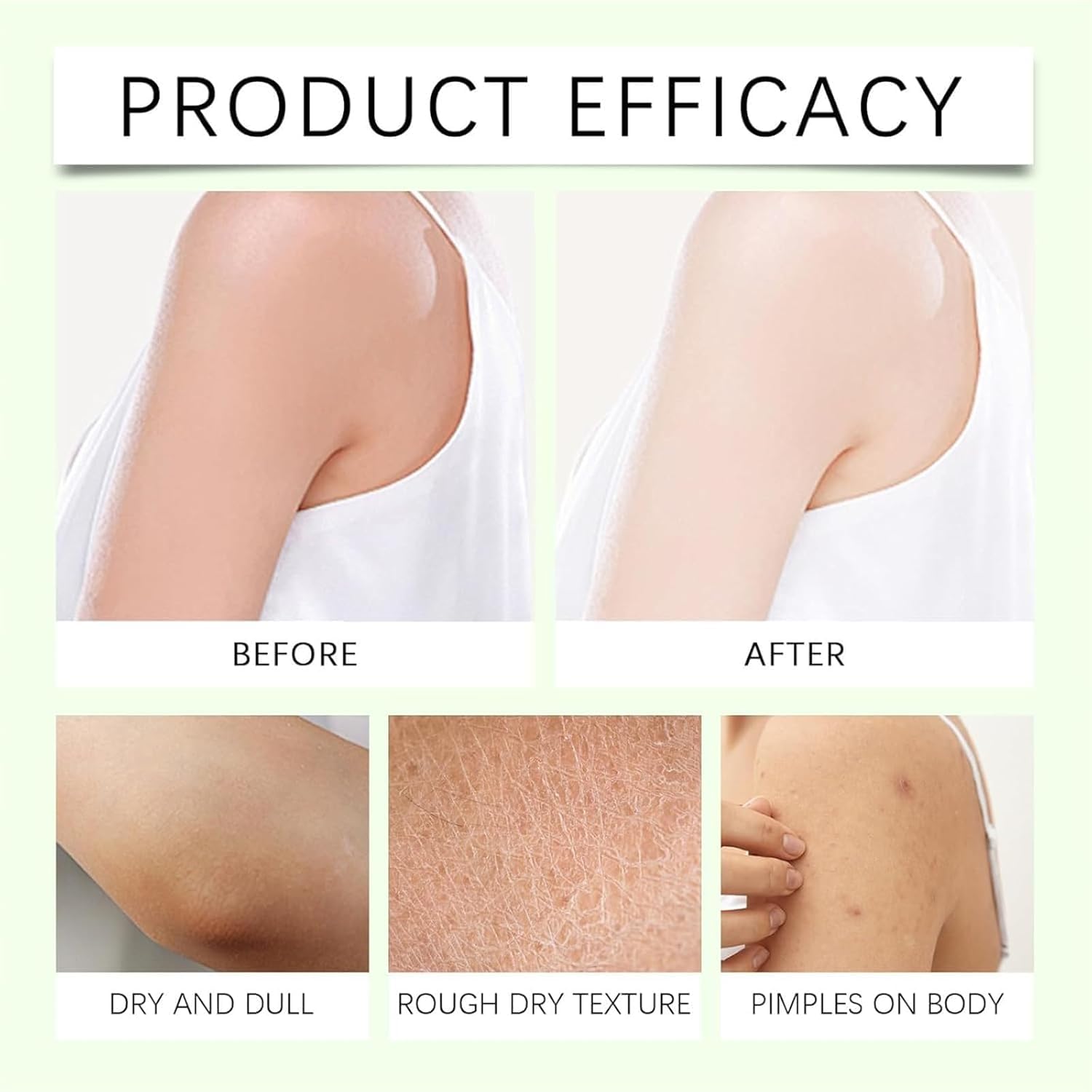 THUIOP Applying creams in routine demonstrates everyday self-care.