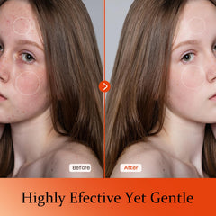 Tinclen Vitamin C Serum on skin with bright glow and even tone