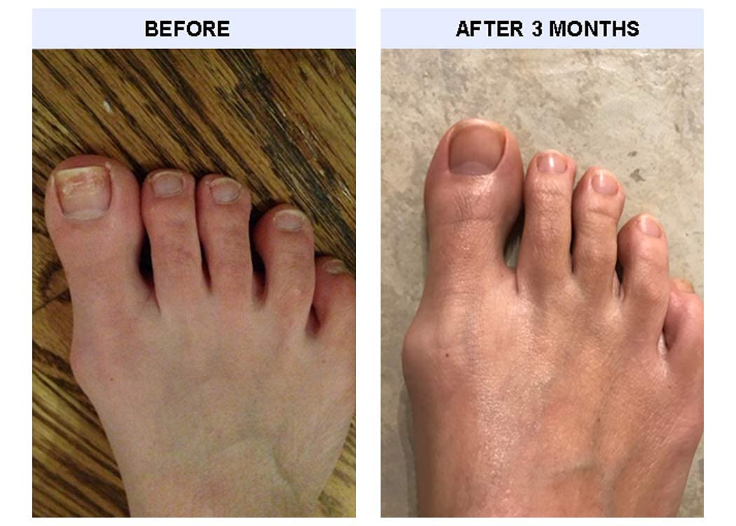 TIPS Toe Nail Conditioner bottle closeup — rich formula for strong, flexible nails