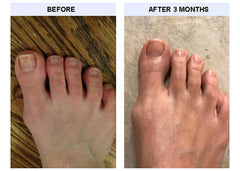 TIPS Toe Nail Conditioner bottle closeup — rich formula for strong, flexible nails