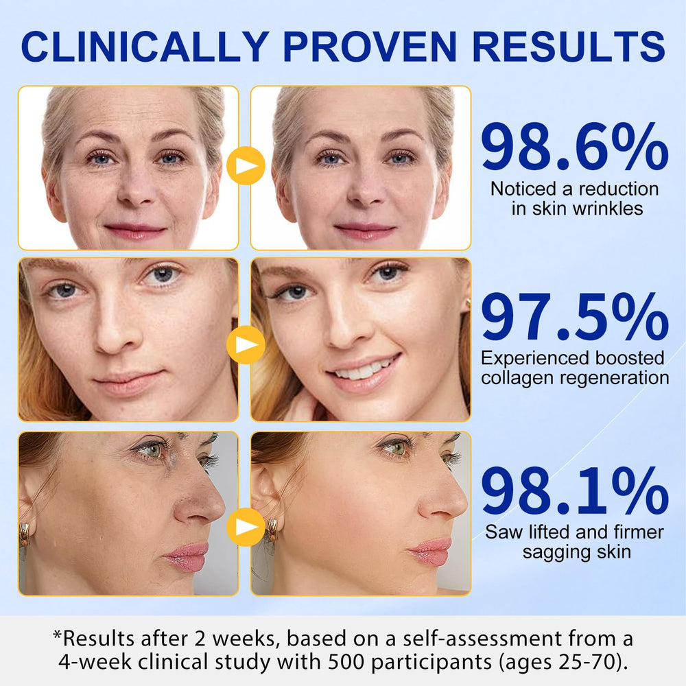 TKTALKER laugh lines targeted application demonstrates focused treatment.