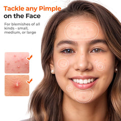 TKTK 10 mm patches offer discreet fit for small blemishes